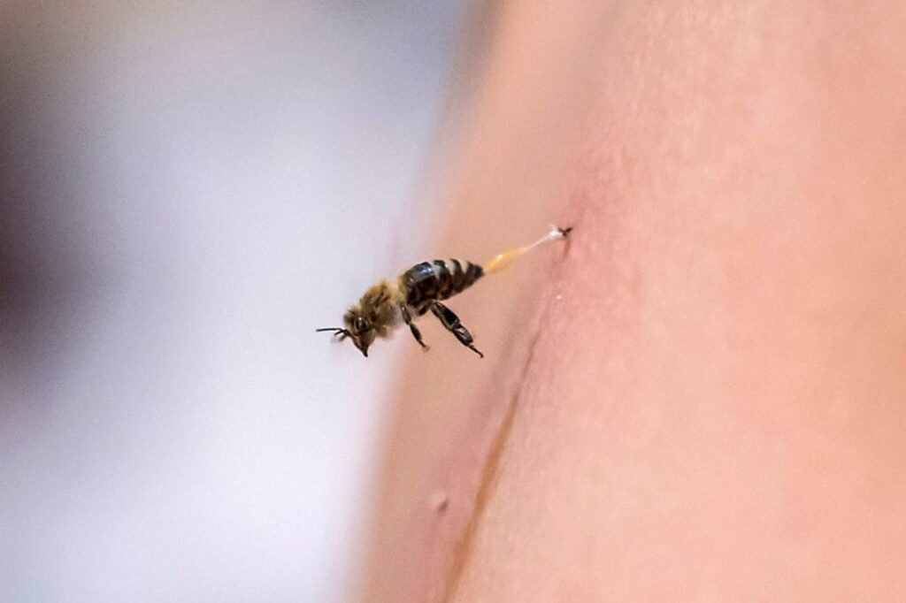 Puntura d'ape: cosa fare subito e quando serve l'antistaminico